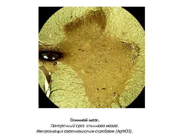 Спинной мозг. Поперечный срез спинного мозга. Импрегнация азотнокислым серебром (Ag. NO 3). 