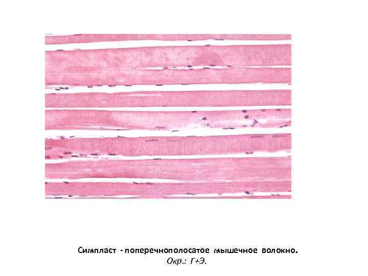 Симпласт - поперечнополосатое мышечное волокно. Окр. : Г+Э. 