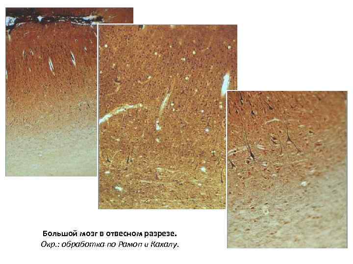 Большой мозг в отвесном разрезе. Окр. : обработка по Рамоп и Кахалу. 