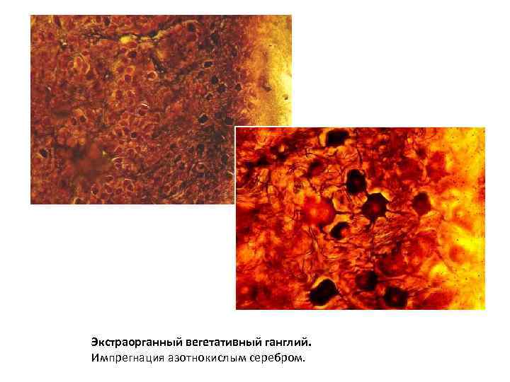 Экстраорганный вегетативный ганглий. Импрегнация азотнокислым серебром. 