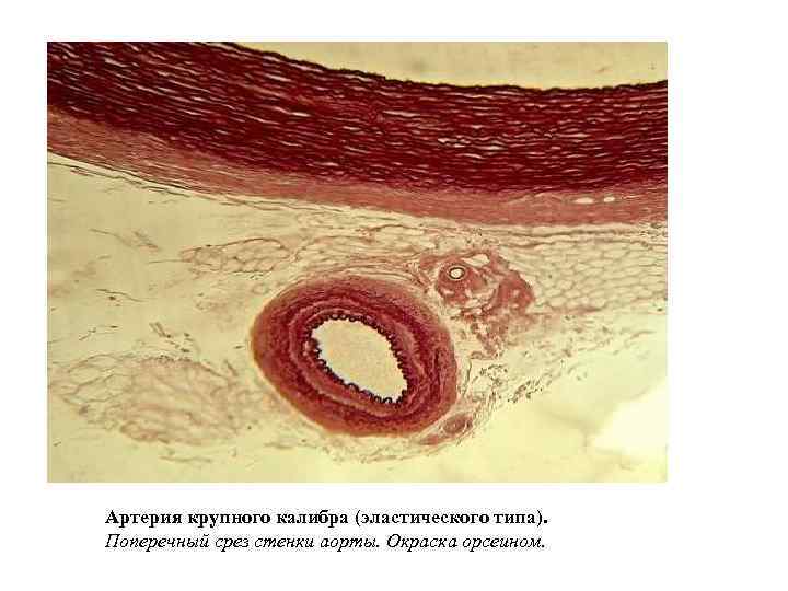 Артерия крупного калибра (эластического типа). Поперечный срез стенки аорты. Окраска орсеином. 