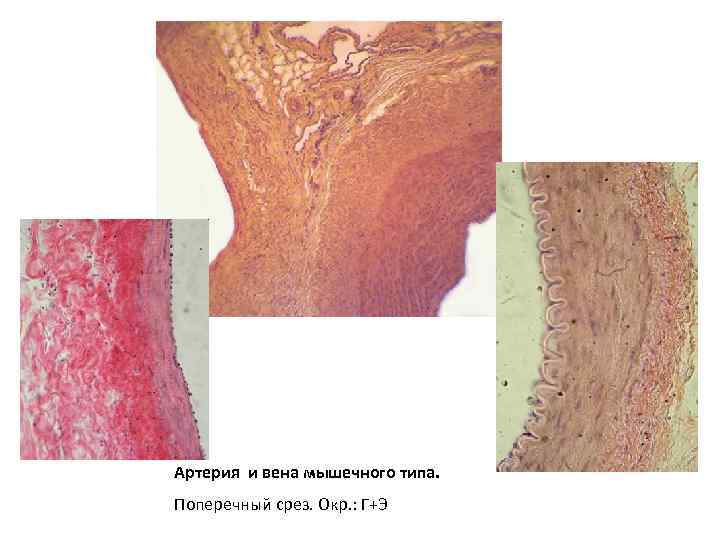 Артерия и вена мышечного типа. Поперечный срез. Окр. : Г+Э 