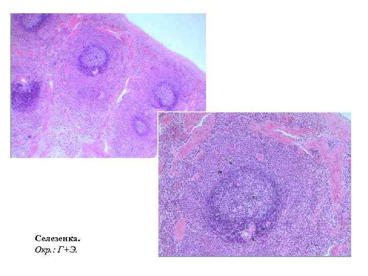 Селезенка. Окр. : Г+Э. 
