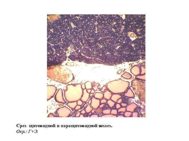 Железистые клетки печени вырабатывают. Клетки Гольджи гистология. Клетки Гольджи мозжечка. Паращитовидная железа срез.