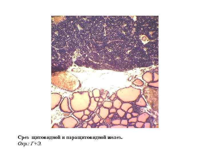 Срез щитовидной и паращитовидной желез. Окр. : Г+Э. 