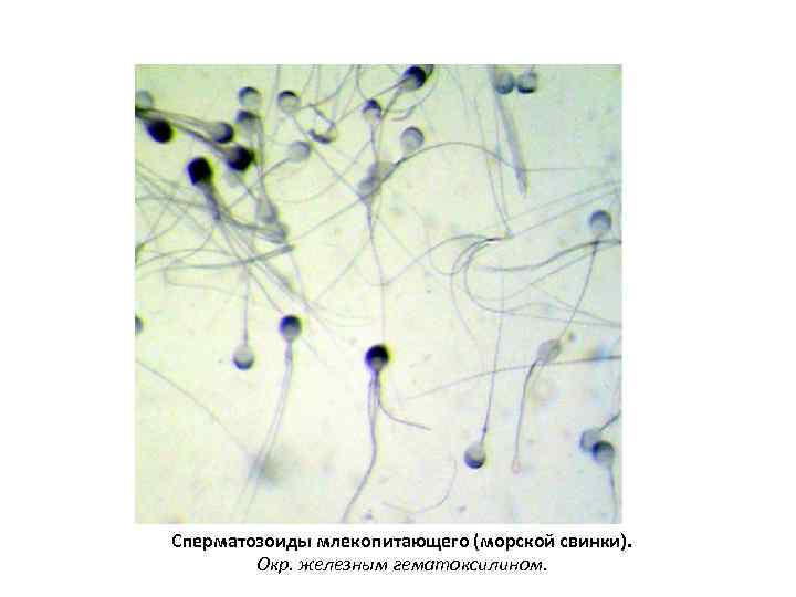 Сперматозоиды млекопитающего (морской свинки). Окр. железным гематоксилином. 