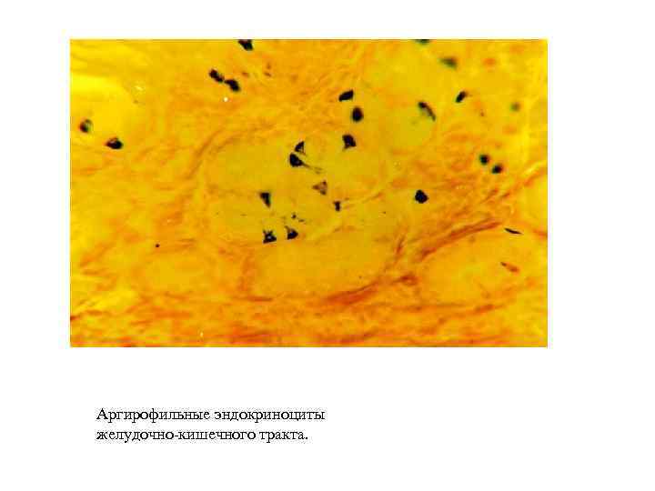 Аргирофильные эндокриноциты желудочно-кишечного тракта. 