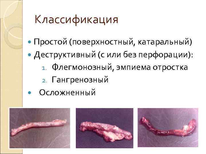 Классификация Простой (поверхностный, катаральный) Деструктивный (с или без перфорации): Флегмонозный, эмпиема отростка 2. Гангренозный