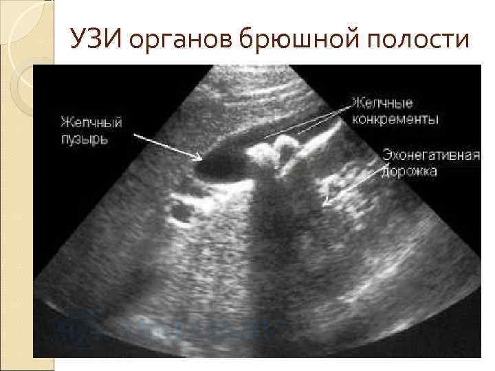 Направление на узи органов брюшной полости образец