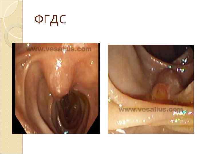 ФГДС 