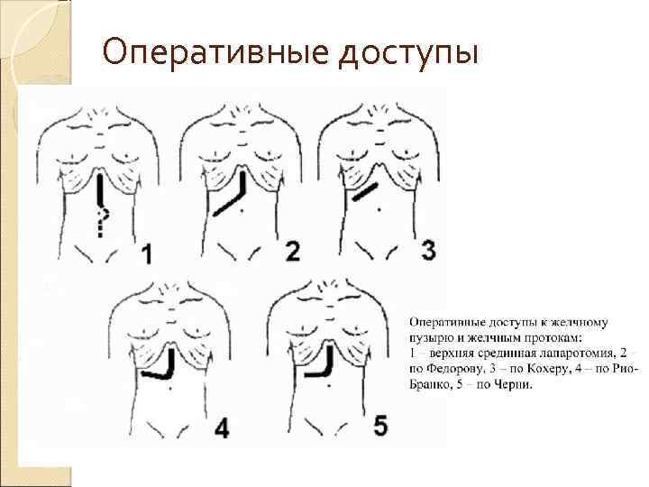 Карман риделя рисунок