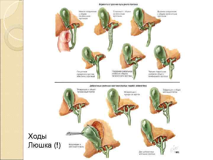 Ходы Люшка (!) 