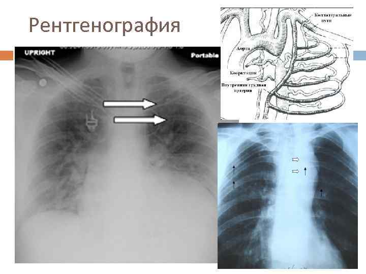 Рентгенография 