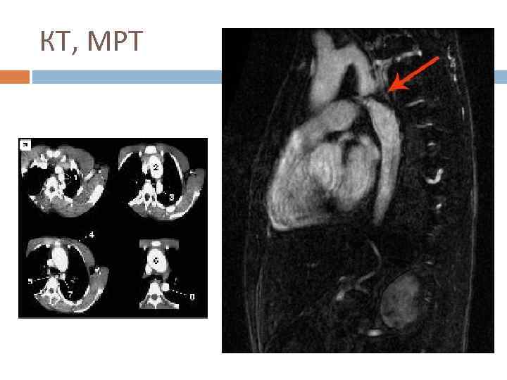 КТ, МРТ 