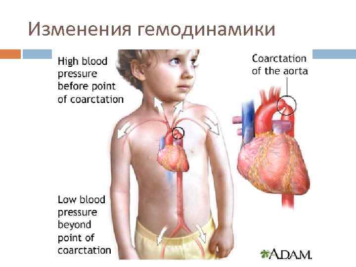 Изменения гемодинамики 