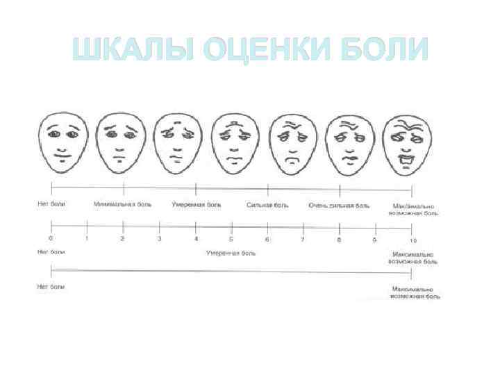 ШКАЛЫ ОЦЕНКИ БОЛИ 