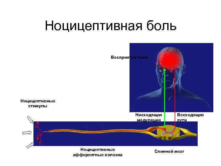 Ноцицептивная боль Восприятие боли Ноцицептивные стимулы Нисходящая модуляция Ноцицептивные афферентные волокна Восходящие пути Спинной