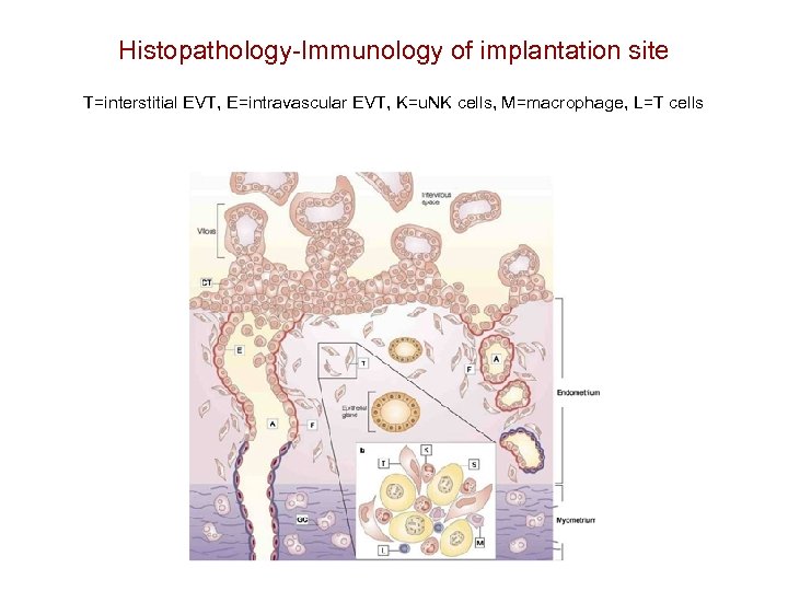 Histopathology-Immunology of implantation site T=interstitial EVT, E=intravascular EVT, K=u. NK cells, M=macrophage, L=T cells