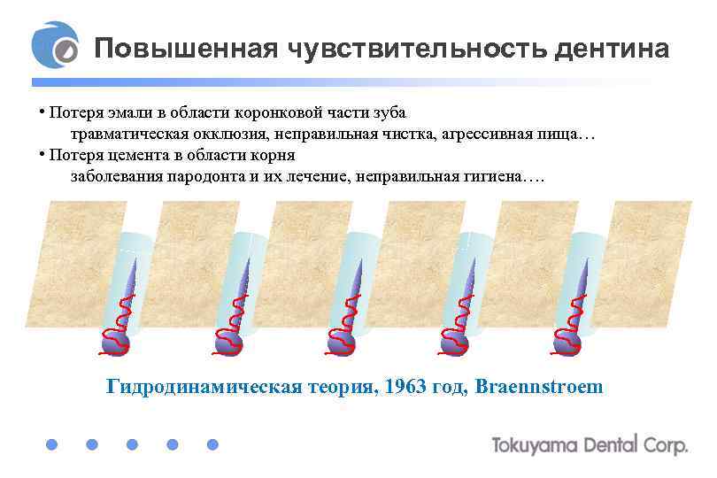 Повышенная чувствительность дентина • Потеря эмали в области коронковой части зуба травматическая окклюзия, неправильная