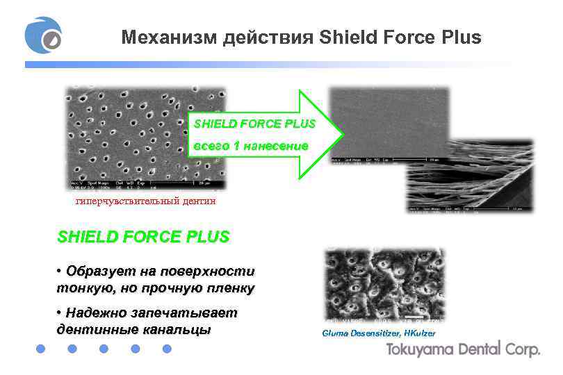 Механизм действия Shield Force Plus SHIELD FORCE PLUS всего 1 нанесение гиперчувствительный дентин SHIELD