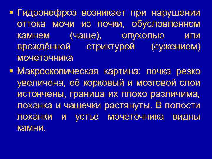 § Гидронефроз возникает при нарушении оттока мочи из почки, обусловленном камнем (чаще), опухолью или