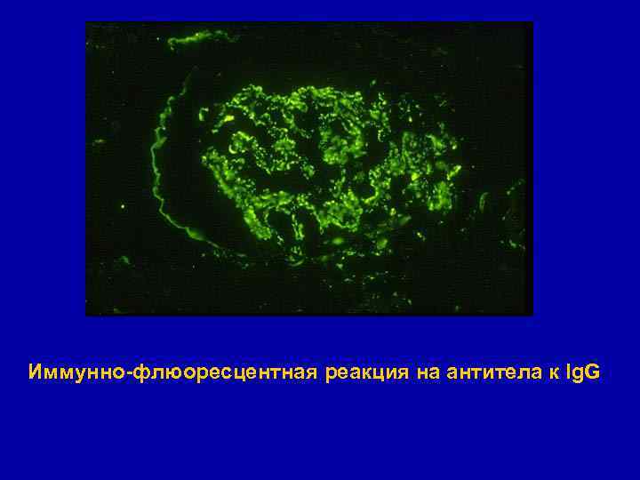 Иммунно-флюоресцентная реакция на антитела к Ig. G 