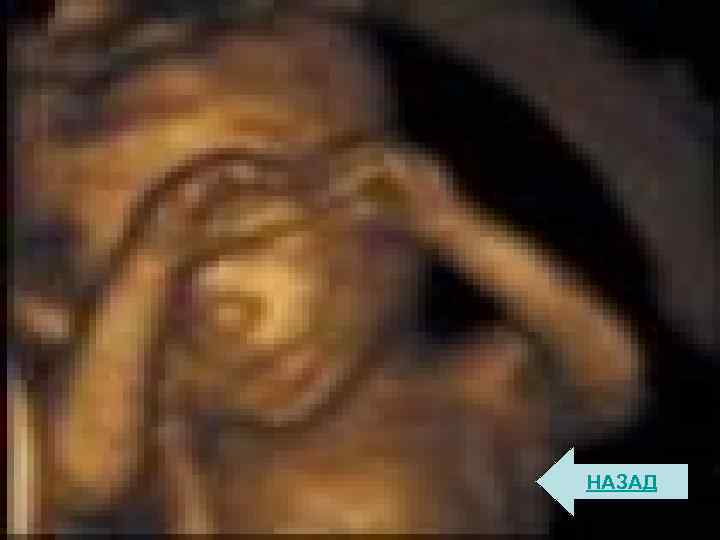 НАЗАД 