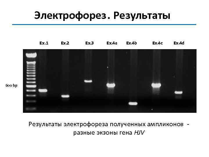 Электрофорез. Результаты Ex. 1 Ex. 2 Ex. 3 Ex. 4 a Ex. 4 b