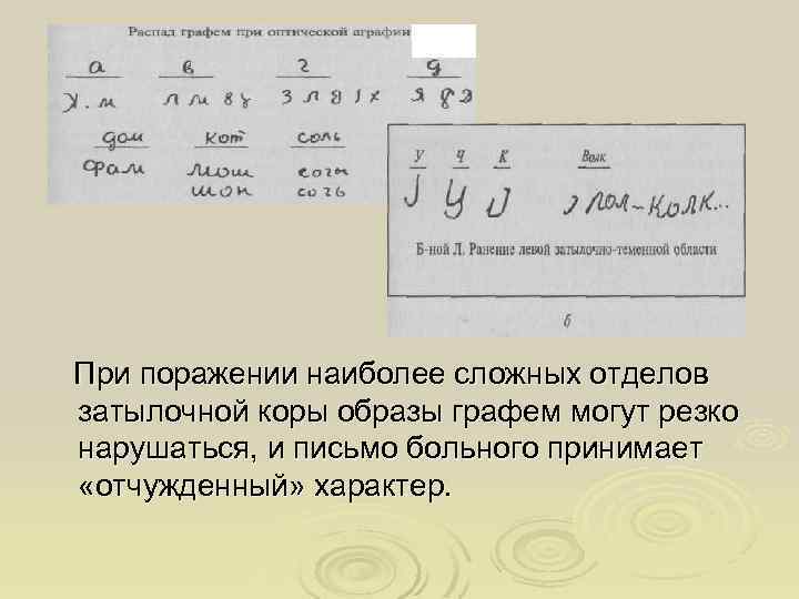 При поражении наиболее сложных отделов затылочной коры образы графем могут резко нарушаться, и письмо