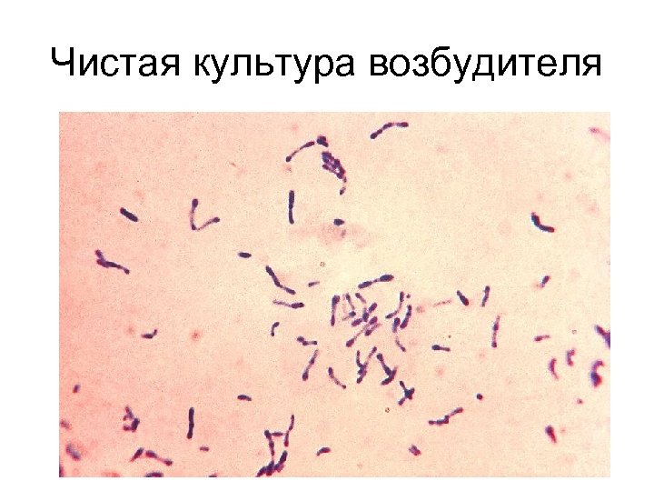 Чистая культура возбудителя 