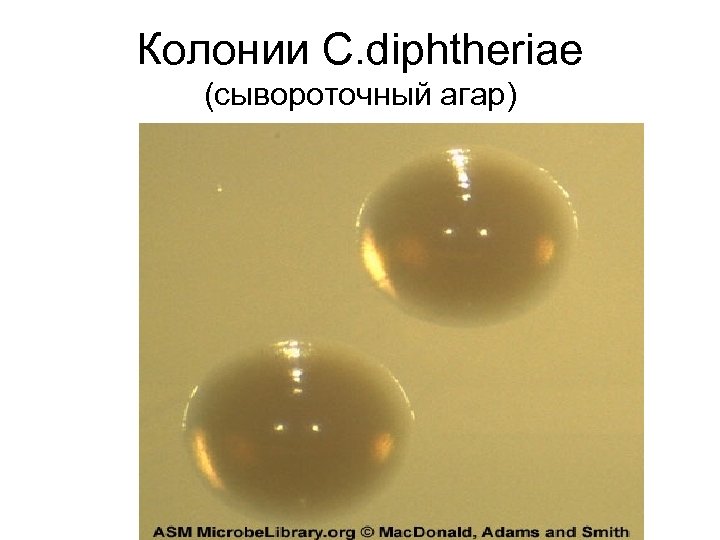 Колонии C. diphtheriae (сывороточный агар) 