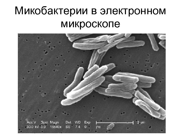 Микобактерии в электронном микроскопе 