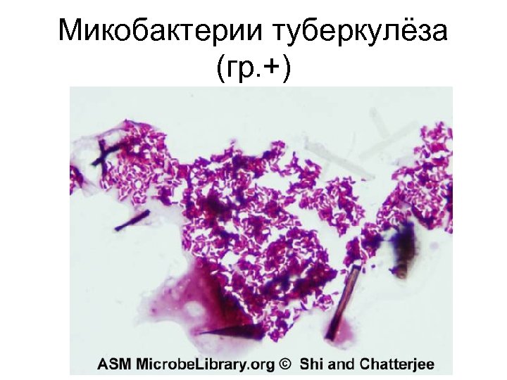 Микобактерии туберкулёза (гр. +) 
