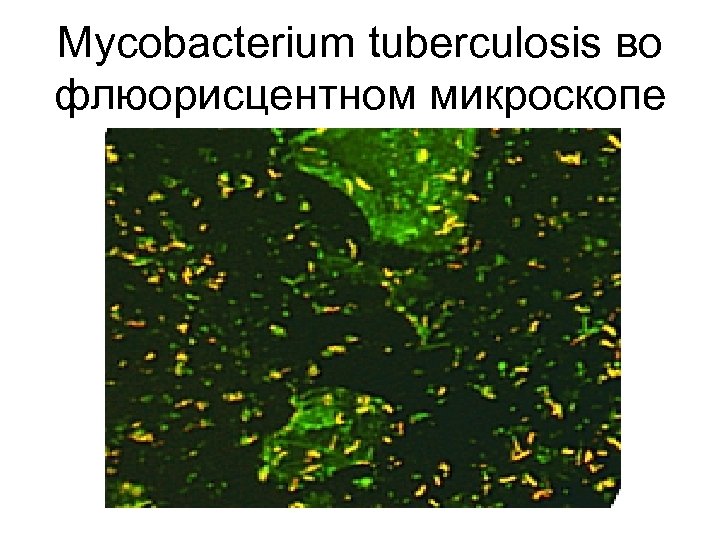 Mycobacterium tuberculosis во флюорисцентном микроскопе 