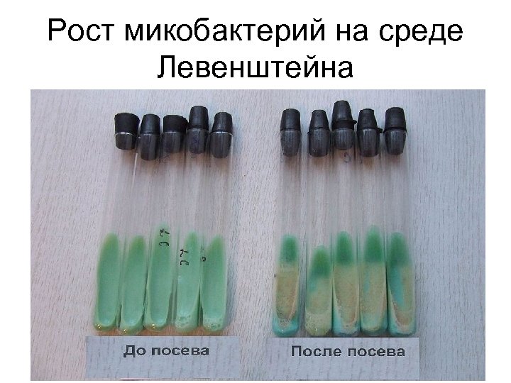 Рост микобактерий на среде Левенштейна 