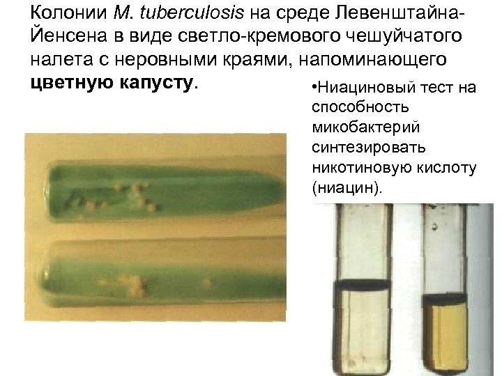 Колонии М. tuberculosis на среде Левенштайна. Йенсена в виде светло-кремового чешуйчатого налета с неровными