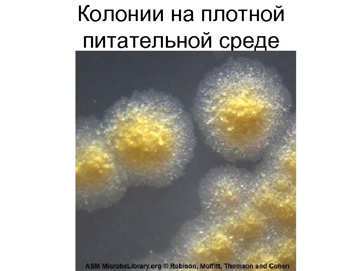 Колонии на плотной питательной среде 