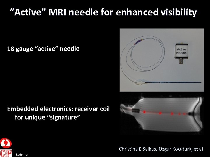“Active” MRI needle for enhanced visibility 18 gauge “active” needle Embedded electronics: receiver coil