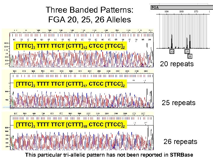 Three Banded Patterns: FGA 20, 25, 26 Alleles [TTTC]3 TTTT TTCT [CTTT]12 CTCC [TTCC]2