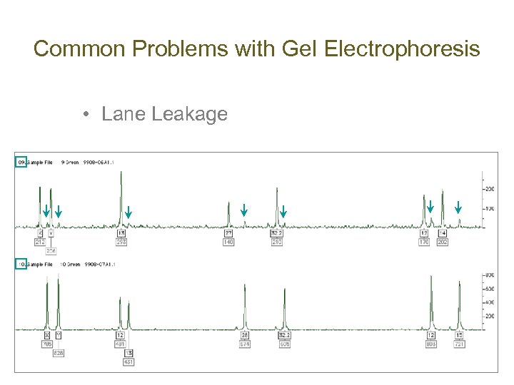 protein electrophoresis mnemonic