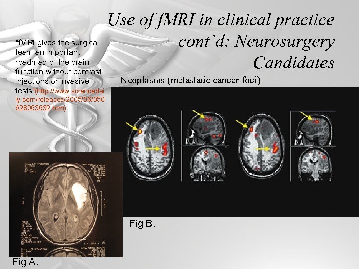 Use of f. MRI in clinical practice 