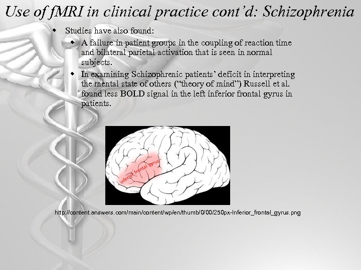Use of f. MRI in clinical practice cont’d: Schizophrenia w Studies have also found: