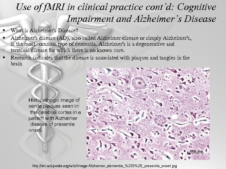 Use of f. MRI in clinical practice cont’d: Cognitive Impairment and Alzheimer’s Disease w