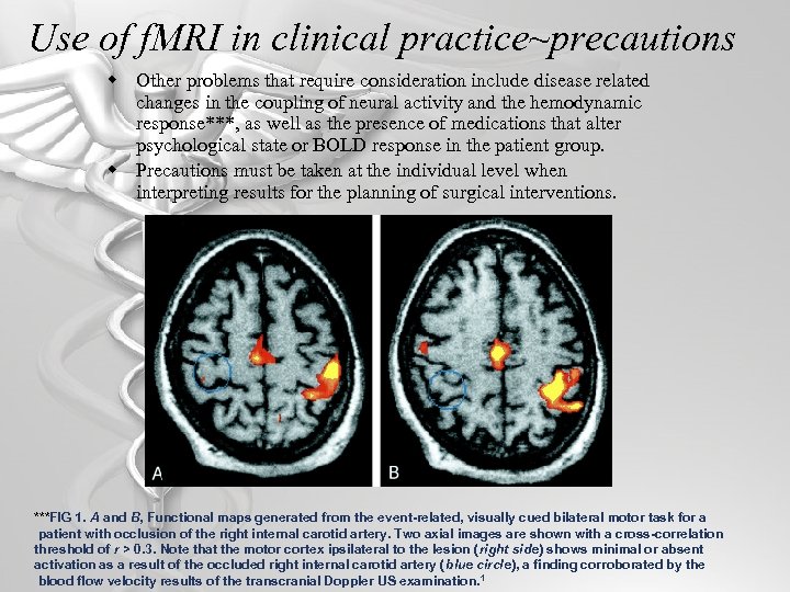 Use of f. MRI in clinical practice~precautions w Other problems that require consideration include