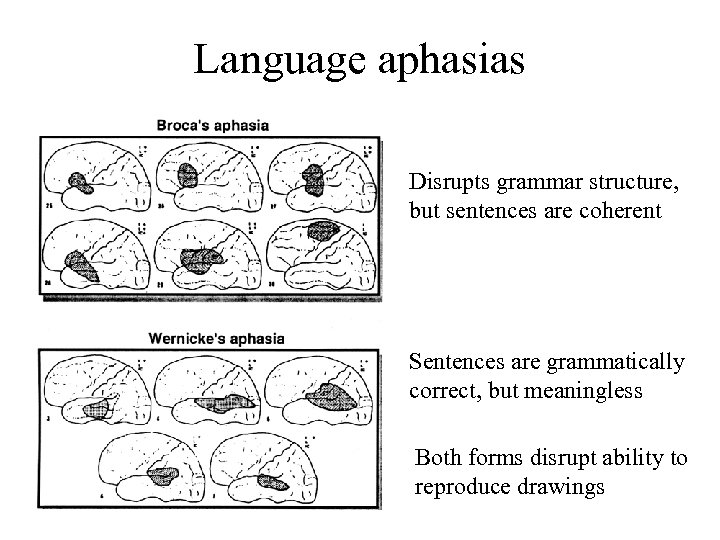 Language aphasias Disrupts grammar structure, but sentences are coherent Sentences are grammatically correct, but