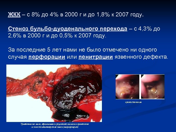 ЖКК – с 8% до 4% в 2000 г и до 1, 8% к