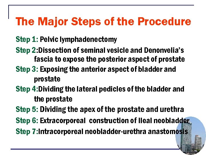 The Major Steps of the Procedure Step 1: Pelvic lymphadenectomy Step 2: Dissection of