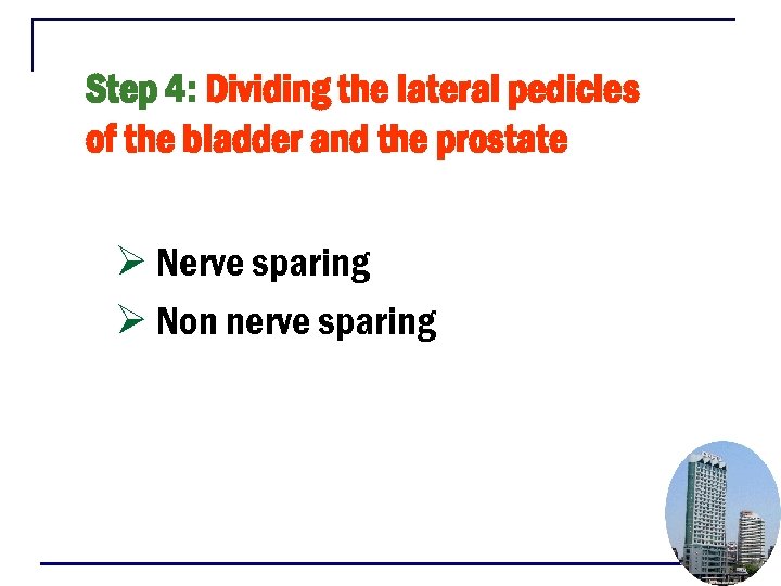 Step 4: Dividing the lateral pedicles of the bladder and the prostate Ø Nerve