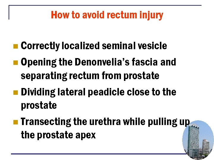 How to avoid rectum injury Correctly localized seminal vesicle n Opening the Denonvelia’s fascia