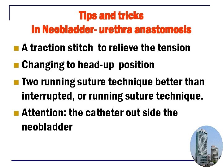 Tips and tricks in Neobladder- urethra anastomosis A traction stitch to relieve the tension